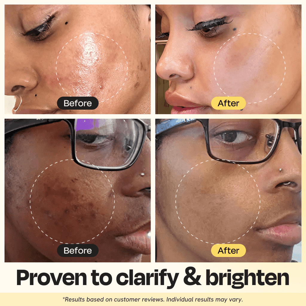 Gleamin - Vitamin C Clay Mask