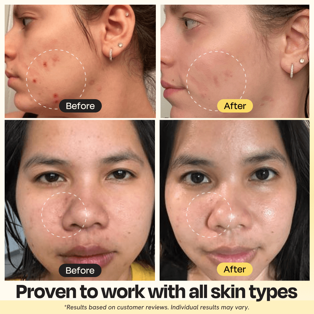 Gleamin - Vitamin C Clay Mask